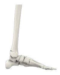 Ankle Fractures